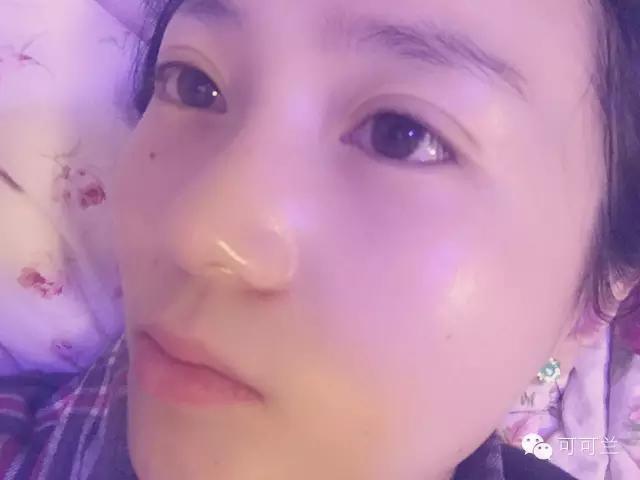 没有人会告诉你的这些护肤问题