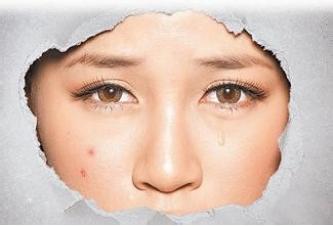 激素皮炎中医治疗,激素皮炎激素脸的特征