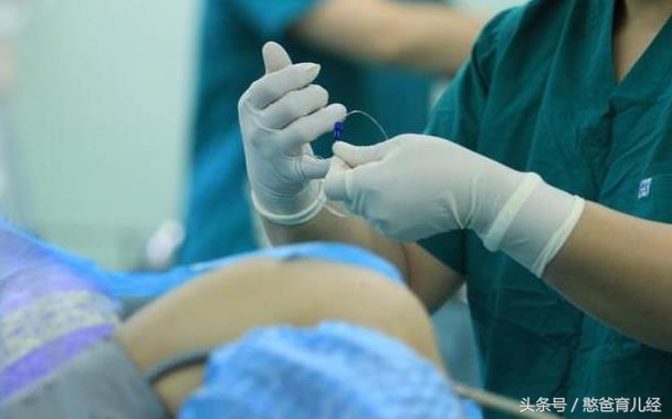 顺产的宝妈都知道要备皮,可是剖腹产也需要备皮吗?