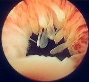 女性哪些妇科疾病需要做微创手术,女性常见的十大妇科疾病症状