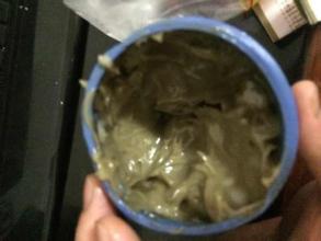 牛皮癣的病友,牛皮癣病友自述