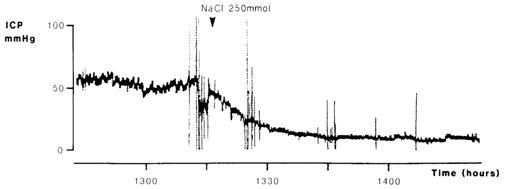 良性高颅压怎么治疗,高颅压治疗