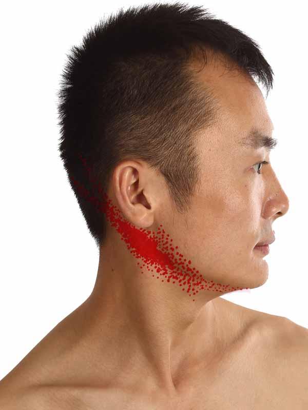 脖子淋巴肿了吃药不见效怎么办,脖子淋巴炎输液有效果吗