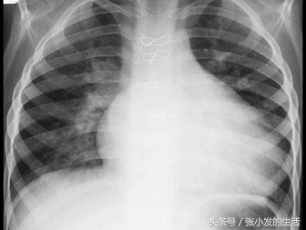 儿科中级加强版考前试题及答案（题二）