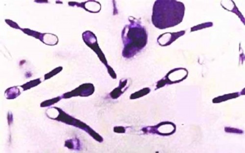 30岁烫伤用打破伤风针么,烫伤起水泡需要打破伤风吗