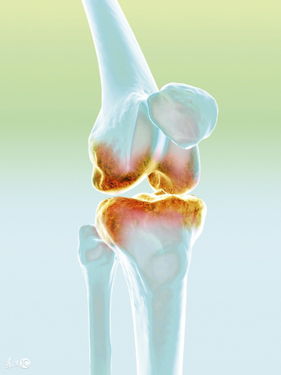 中医中药推拿治疗风湿关节炎,中医治疗风湿关节炎