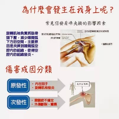 排球运动员如何保护肩关节,排球运动容易出现肩袖肌群损伤