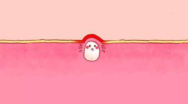 长了闭口粉刺之后怎么办