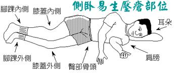 压疮的普及,压疮演变