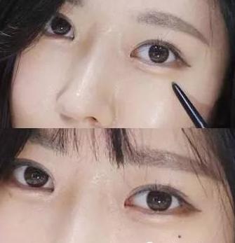 赵丽颖脸部痣,赵丽颖脸上美人痣