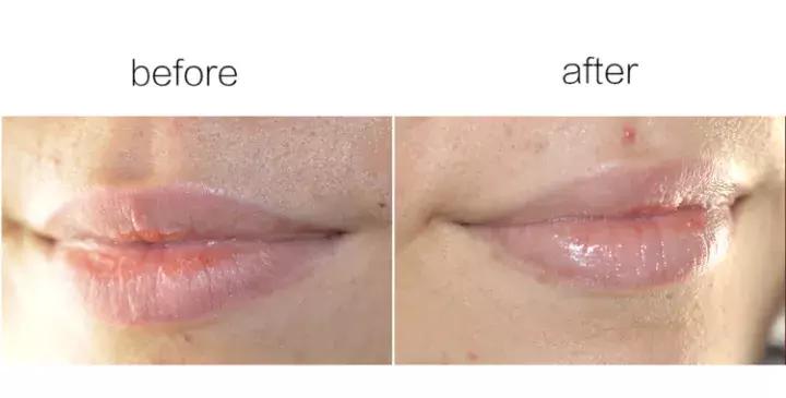 秋冬季节嘴唇干燥起皮怎么办,润唇膏夏季推荐