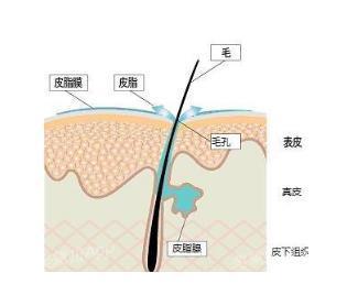 痘痘粉刺怎么根治,粉刺没有处理好变成硬疙瘩
