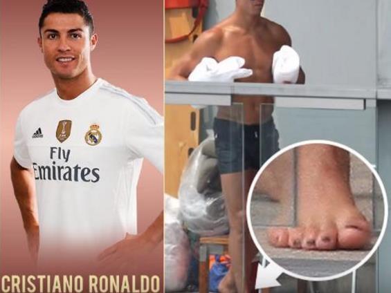 科比的手指詹姆斯的脚趾,科比的手指和脚趾