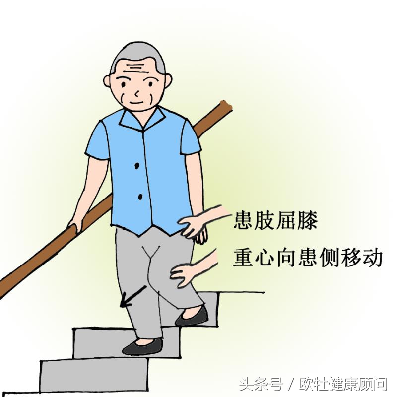 脑中风步态训练,脑中风康复学