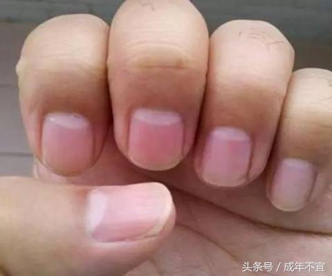 手指上没有半月牙是啥原因,手指半月牙代表什么