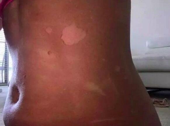 网红防晒霜事件 (澳洲防晒真的假的)