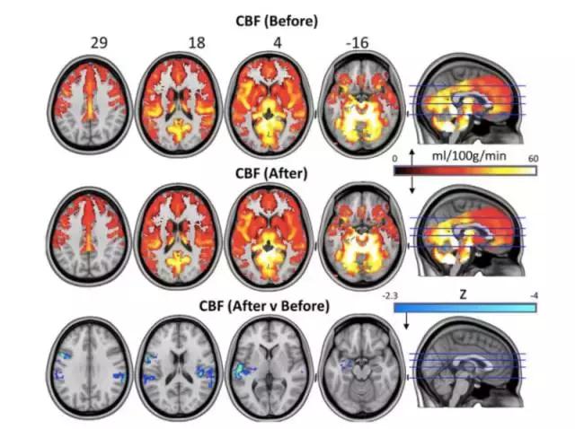 致幻蘑菇病症,致幻类蘑菇的危害