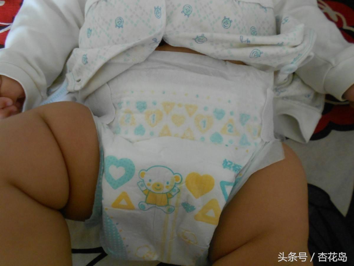 宝宝绑腿能矫正o型腿吗,宝宝o型腿能绑吗