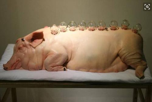 拔罐,是养生还是自虐?|话题吧