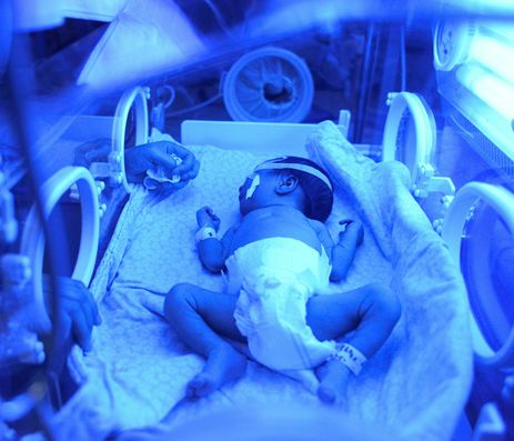 宝妈宝爸o型血宝宝黄疸高怎么办,宝妈宝宝黄疸