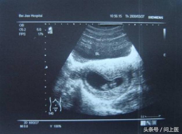 不要相信一些所谓的传言,不要轻易相信那些不靠谱的人