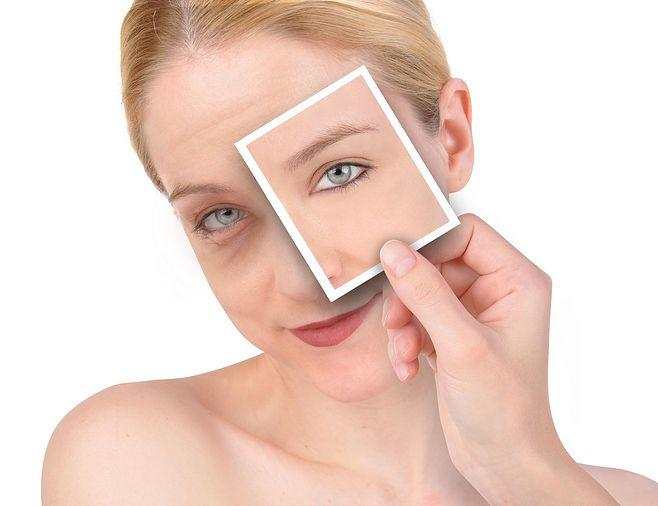 假性眼纹应该做什么项目,打眼纹打出假性眼袋怎么处理