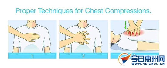 为心脏骤停的老人进行心肺复苏,护士心肺复苏救活七旬老人