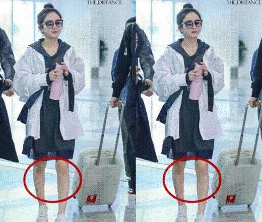 膝盖容易撞到淤青,膝盖经常磕伤怎么回事