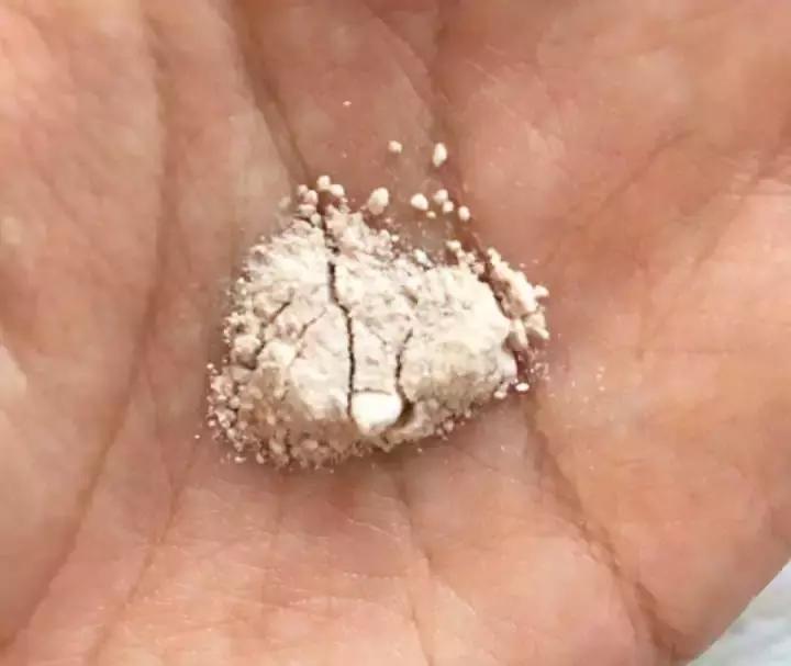 有痘痘痘印使用什么洁面乳,什么洁面乳祛痘痘