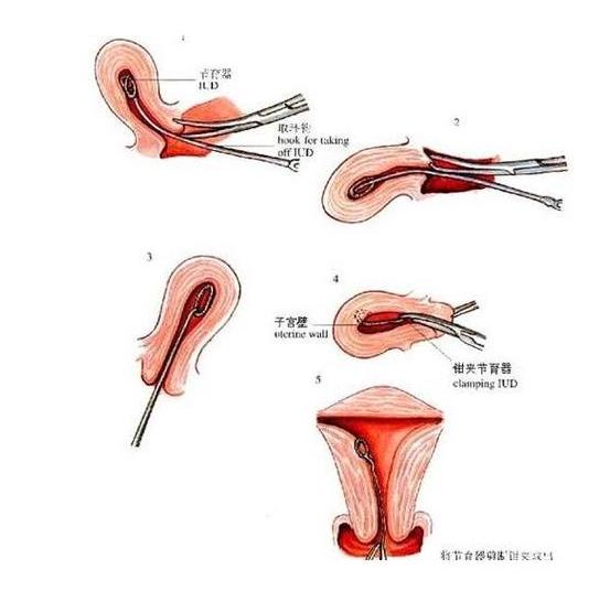 生完孩子该经历的四件事,生完娃以后才知道的真相