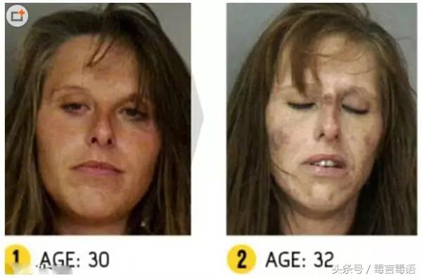 10个吸毒前后的惊人变化,吸毒的人吸毒前后对比图片