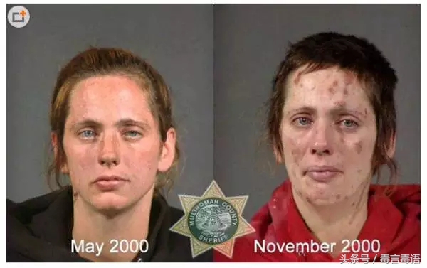 10个吸毒前后的惊人变化,吸毒的人吸毒前后对比图片