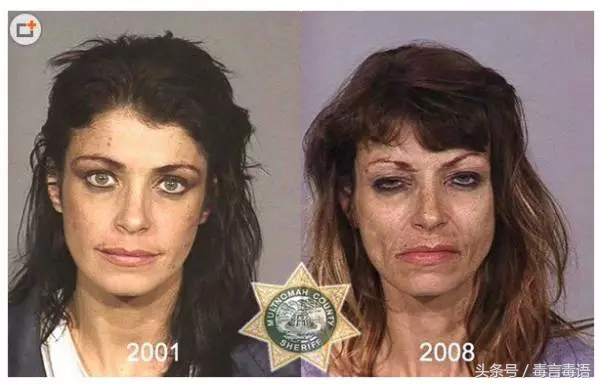 10个吸毒前后的惊人变化,吸毒的人吸毒前后对比图片