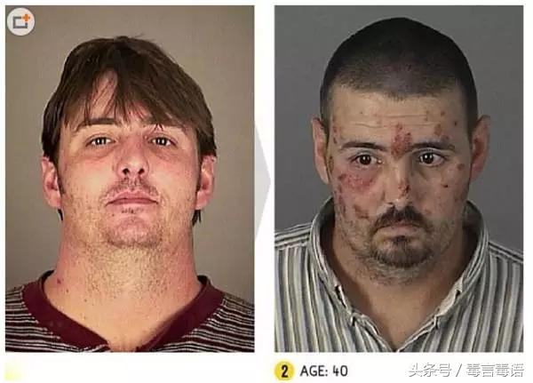 10个吸毒前后的惊人变化,吸毒的人吸毒前后对比图片