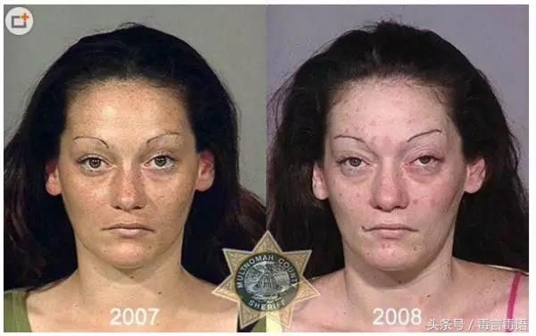 吸毒前后的变化对比,吸毒真的会毁容吗