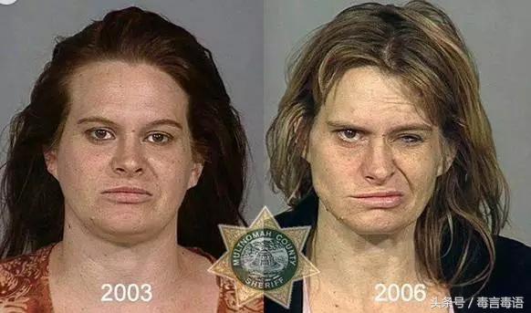 10个吸毒前后的惊人变化,吸毒的人吸毒前后对比图片