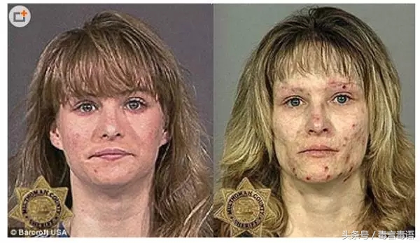 10个吸毒前后的惊人变化,吸毒的人吸毒前后对比图片