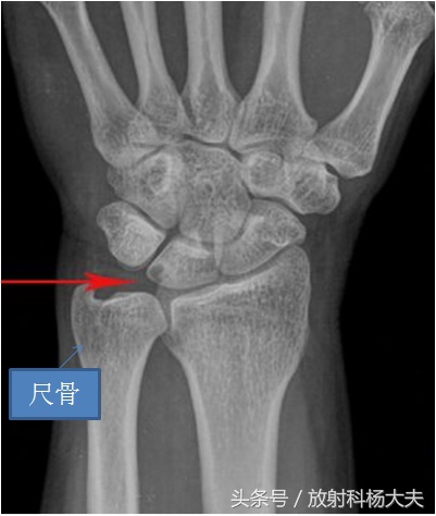 使用电脑常出现问题有哪些,使用电脑时电脑常出现的问题