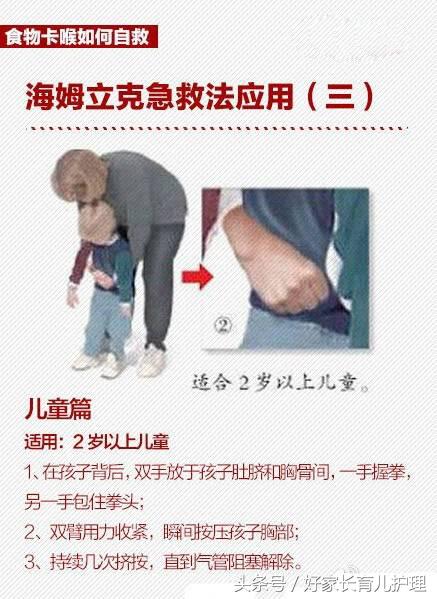 桂圆卡住喉咙致死,被桂圆卡喉咙急救法