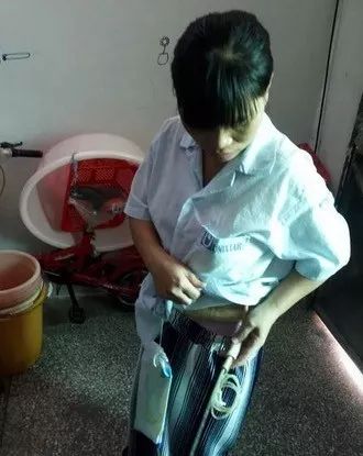 女子路上被撞200元私了,女子被车撞花费7万元看病