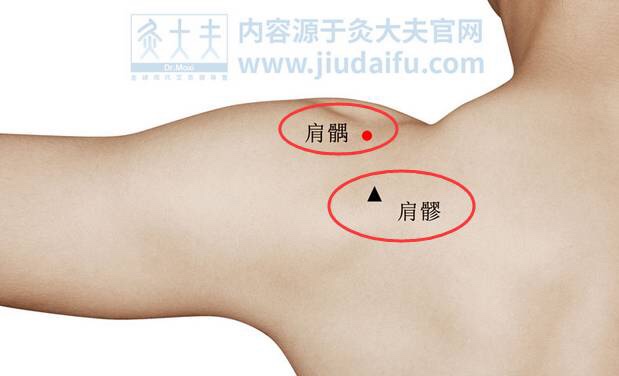 艾灸治疗肩周炎,是健康安全的优选方案