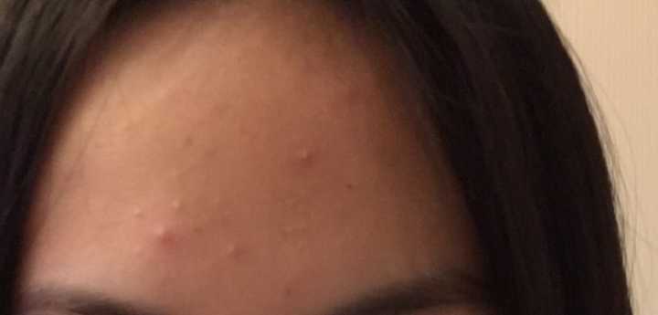 帮仙女们解决各种皮肤问题,给仙女们好好保养皮肤