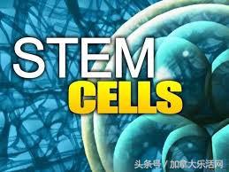 张家卫硅谷百日散记（二十二）器官移植和干细胞移不再昂贵