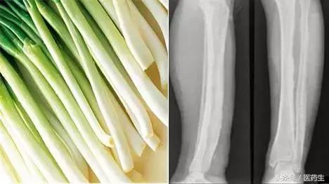 舌尖上的医疗,舌尖上的医疗篇