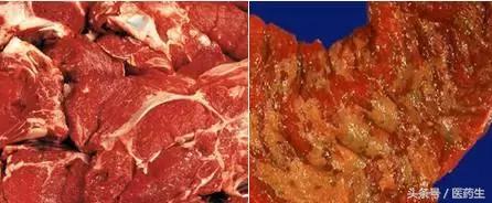 舌尖上的医疗,舌尖上的医疗篇