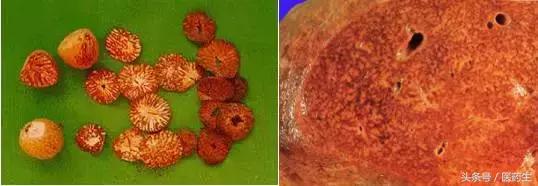 舌尖上的医疗,舌尖上的医疗篇