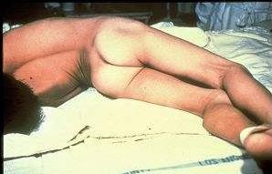 脚上长奇奇怪怪的东西是什么,脚上长像面包糠样的东西