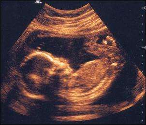 怀孕七大冷知识,各种怀孕小知识