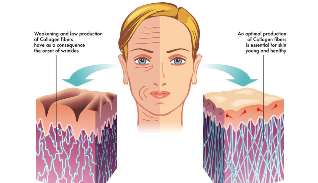 女大学生泪沟黑眼圈用什么眼霜,眼霜能去脂肪粒吗