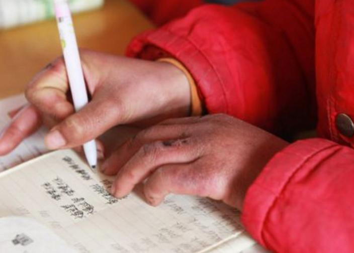 养一盆好养活又好看的花,牙疼养什么花最好